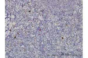 Image no. 1 for anti-NFKB Inhibitor Interacting Ras-Like 2 (NKIRAS2) (AA 1-192) antibody (ABIN599224) (NKIRAS2 Antikörper  (AA 1-192))