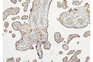 IHC analysis of IRS1 using anti-IRS1 antibody (ABIN7599659). (IRS1 Antikörper  (AA 1041-1242))