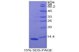 SDS-PAGE analysis of Cow S100A10 Protein.