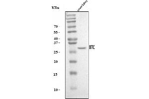 Western blot analysis of Btc using anti-Btc antibody (ABIN7601294).