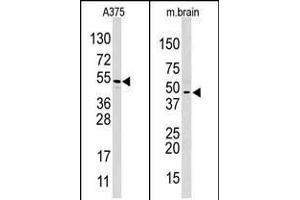 Western blot analysis of anti-HIF1AN (C-term) Pab in  and mouse brain cell line lysate. (HIF1AN Antikörper  (C-Term))