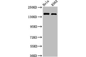 Western Blot Positive WB detected in: Hela whole cell lysate, K562 whole cell lysate All lanes: CDK12 antibody at 2 μg/mL Secondary Goat polyclonal to rabbit IgG at 1/50000 dilution Predicted band size: 165, 164, 142 kDa Observed band size: 165 kDa (CDK12 Antikörper  (AA 1309-1490))