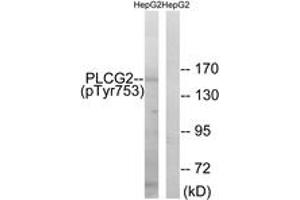 Western blot analysis of extracts from HepG2 cells treated with Na3VO4 0. (Phospholipase C gamma 2 Antikörper  (pTyr753))