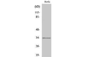 Western Blotting (WB) image for anti-Olfactory Receptor, Family 1, Subfamily L, Member 6 (OR1L6) (Internal Region) antibody (ABIN3186039) (OR1L6 Antikörper  (Internal Region))