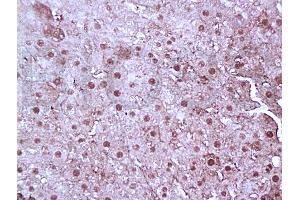 Formalin-fixed and paraffin embedded rat liver tissue labeled with Anti-FoxP3 Polyclonal Antibody, Unconjugated (ABIN727040) at 1:100, followed by conjugation to the secondary antibody and DAB staining (FOXP3 Antikörper)