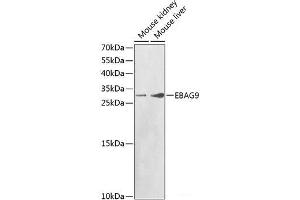 Western blot analysis of extracts of various cell lines using EBAG9 Polyclonal Antibody at dilution of 1:1000. (RCAS1 Antikörper)