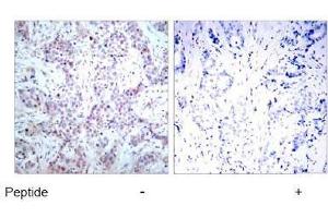 Image no. 1 for anti-Nuclear Factor-kB p65 (NFkBP65) (AA 534-538) antibody (ABIN197116) (NF-kB p65 Antikörper  (AA 534-538))