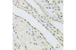 Immunohistochemistry of paraffin-embedded human kidney using DDB1 Antibody. (DDB1 Antikörper)