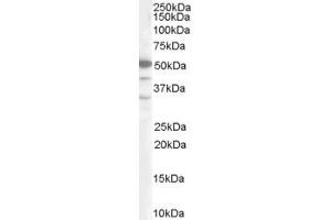 Western Blotting (WB) image for anti-SWI/SNF Related, Matrix Associated, Actin Dependent Regulator of Chromatin, Subfamily E, Member 1 (SMARCE1) (C-Term) antibody (ABIN2465457) (SMARCE1 Antikörper  (C-Term))