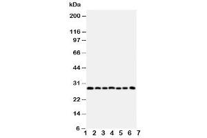 Western blot testing of Kallikrein-11 antibody and Lane 1:  U87 (Kallikrein 11 Antikörper  (C-Term))