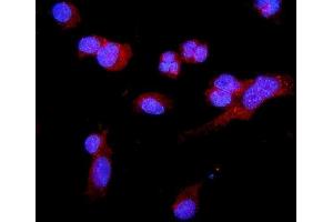 IF analysis of C5a-R/C5ar1 using anti-C5a-R/C5ar1 antibody (ABIN7601126).