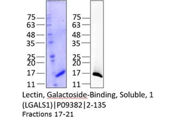 LGALS1/Galectin 1 Protein (AA 2-135) (His tag)