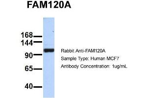 Host: Rabbit   Target Name: FAM120A   Sample Tissue: MCF7  Antibody Dilution: 1. (FAM120A Antikörper  (Middle Region))