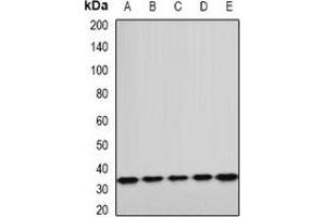 Western blot analysis of ETFA expression in A549 (A), HepG2 (B), mouse kidney (C), mouse heart (D), rat liver (E) whole cell lysates. (ETFA Antikörper)