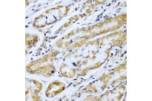 Immunohistochemical analysis of SUFU staining in human stomach formalin fixed paraffin embedded tissue section.