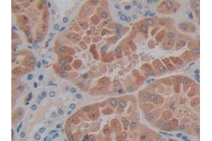 IHC-P analysis of Human Kidney Tissue, with DAB staining. (SP140 Antikörper  (AA 443-655))