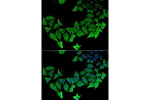 Immunofluorescence analysis of HeLa cells using APLP1 antibody. (APLP1 Antikörper  (AA 39-300))