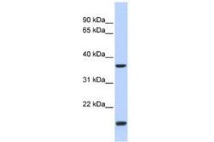 Image no. 1 for anti-Zic Family Member 4 (ZIC4) (N-Term) antibody (ABIN6740619) (ZIC4 Antikörper  (N-Term))
