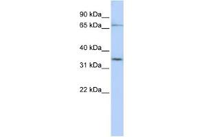 Western Blotting (WB) image for anti-Solute Carrier Organic Anion Transporter Family, Member 1C1 (SLCO1C1) (N-Term) antibody (ABIN2781650)