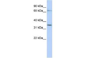 WB Suggested Anti-SLCO1C1 Antibody Titration:  0. (SLCO1C1 Antikörper  (N-Term))