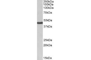 ABIN570953 (1µg/ml) staining of Human Kidney lysate (35µg protein in RIPA buffer). (KCNJ1 Antikörper  (Internal Region))