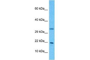 Host:  Rabbit  Target Name:  NDUFB11  Sample Type:  Hela Whole Cell lysates  Antibody Dilution:  1. (NDUFB11 Antikörper  (N-Term))