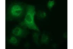 Anti-ALDH1L1 mouse monoclonal antibody (ABIN2452748) immunofluorescent staining of COS7 cells transiently transfected by pCMV6-ENTRY ALDH1L1 (RC213720). (ALDH1L1 Antikörper)