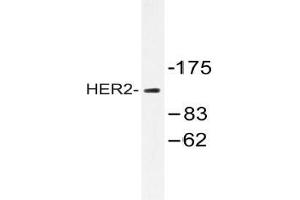 Western blot analysis of HER2 antibody in extracts from 293 cells. (ErbB2/Her2 Antikörper)