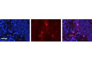 Rabbit Anti-GNA12 Antibody Catalog Number: ARP54813_P050 Formalin Fixed Paraffin Embedded Tissue: Human Ovary Tissue Observed Staining: Plasma membrane Primary Antibody Concentration: 1:100 Other Working Concentrations: 1:600 Secondary Antibody: Donkey anti-Rabbit-Cy3 Secondary Antibody Concentration: 1:200 Magnification: 20X Exposure Time: 0. (GNA12 Antikörper  (Middle Region))
