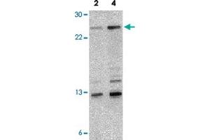 Western blot analysis of NKIRAS1 in 293 cell lysate with NKIRAS1 polyclonal antibody  at 2 and 4 ug/mL . (NKIRAS1 Antikörper  (Internal Region))
