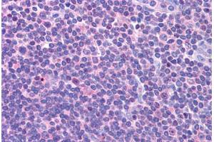Human Lymph Node (formalin-fixed, paraffin-embedded) stained with DCLRE1C antibody ABIN298129 at 1. (DCLRE1C Antikörper  (AA 482-495))