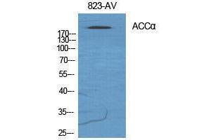 Western Blotting (WB) image for anti-Acetyl-CoA Carboxylase alpha (ACACA) (Ser122) antibody (ABIN3183142)