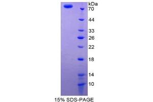 SDS-PAGE (SDS) image for Vitamin D-Binding Protein (GC) (AA 17-476) protein (His tag,GST tag) (ABIN1980999) (Vitamin D-Binding Protein Protein (GC) (AA 17-476) (His tag,GST tag))