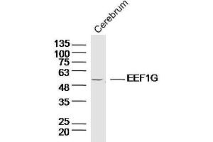Lane 1:Mouse cerebellum lysates probed with EEF1G Polyclonal Antibody, Unconjugated  at 1:300 overnight at 4˚C. (EEF1G Antikörper  (AA 251-350))