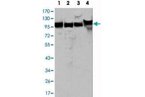 Western blot analysis using MSH2 monoclonal antibody, clone 1B3 (3A2B8C)  against HeLa (1), A-549 (2), A-431 (3) and HEK293 (4) cell lysate. (MSH2 Antikörper)