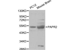 Western blot analysis of various cell lines, using PARK2 antibody. (Parkin Antikörper  (AA 1-300))