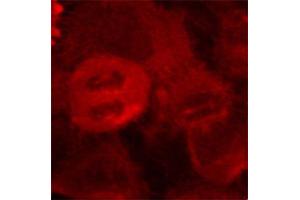Immunofluorescence staining of methanol-fixed HeLa cells using Phospho-MAP2K2-T394 antibody (ABIN2987359). (MEK2 Antikörper  (pThr394))