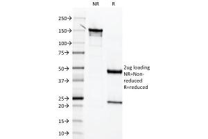 SDS-PAGE Analysis Purified Mesothelin Mouse Monoclonal Antibody (MSLN/2131).