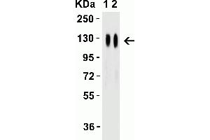 Western Blot Validation with SARS-CoV-2 (COVID-19) Spike Recombinant Protein Loading: 50 ng per lane of SARS-CoV-2 (COVID-19) Spike S1 recombinant protein (97-087). (SARS-CoV-2 Spike Antikörper  (RBD))