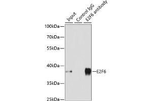 Immunoprecipitation analysis of 200 μg extracts of MCF-7 cells using 3 μg E2F6 antibody (ABIN1679632, ABIN1679631, ABIN5664137 and ABIN6219769). (E2F6 Antikörper  (AA 1-281))
