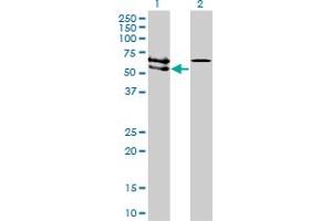 Western Blot analysis of ACVRL1 expression in transfected 293T cell line by ACVRL1 monoclonal antibody (M01), clone 5B1. (ACVRL1 Antikörper  (AA 22-119))