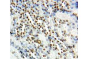 Used in DAB staining on fromalin fixed paraffin-embedded Kidney tissue (Vitamin D Receptor Antikörper  (AA 266-422))