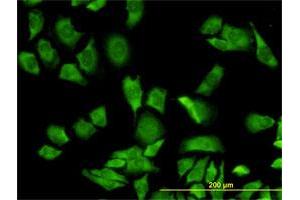 Immunofluorescence of monoclonal antibody to RPL36A on HeLa cell. (RPL36A Antikörper  (AA 7-106))