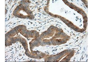 Image no. 3 for anti-Transforming, Acidic Coiled-Coil Containing Protein 3 (TACC3) antibody (ABIN1498098) (TACC3 Antikörper)