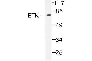 Image no. 1 for anti-BMX Non-Receptor Tyrosine Kinase (BMX) antibody (ABIN272022) (BMX Antikörper)