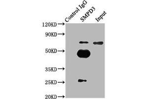 Immunoprecipitating SMPD3 in mouse brain whole cell lysate Lane 1: Rabbit control IgG (1 μg) instead of ABIN7170557 in mouse brain whole cell lysate. (SMPD3 Antikörper  (AA 401-655))