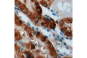 Immunohistochemical analysis of CPT2 staining in mouse kidney formalin fixed paraffin embedded tissue section.