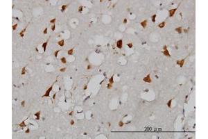 Image no. 3 for anti-Eukaryotic Translation Initiation Factor 2-alpha Kinase 2 (EIF2AK2) (AA 1-101) antibody (ABIN598900) (EIF2AK2 Antikörper  (AA 1-101))