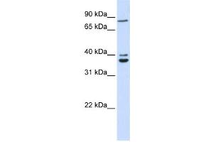 Western Blotting (WB) image for anti-Chromosome 18 Open Reading Frame 10 (C18orf10) antibody (ABIN2459872) (TPGS2 Antikörper)