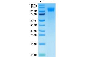 Cynomolgus E-selectin on Tris-Bis PAGE under reduced condition. (Selectin E/CD62e Protein (AA 22-554) (His tag))